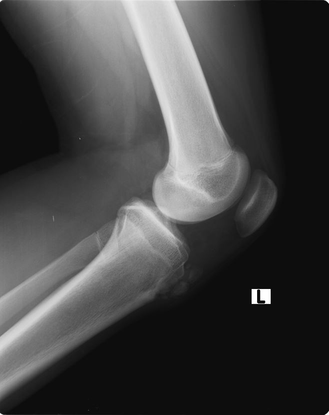 Knee