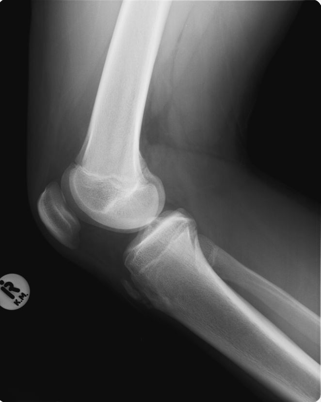 Knee