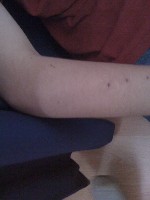 Travis-Arm